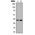 LifeSab™ DNAJB2 Rabbit pAb (50 µl)