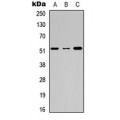 LifeSab™ Factor IX LC Rabbit pAb (50 µl)