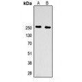 LifeSab™ Factor V HC Rabbit pAb (50 µl)