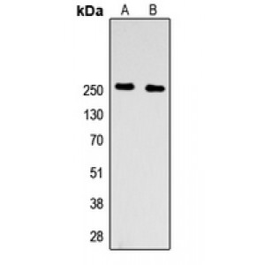 LifeSab™ Factor V HC Rabbit pAb (50 µl)