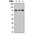 LifeSab™ Factor XI LC Rabbit pAb (50 µl)