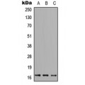 LifeSab™ FUNDC1 Rabbit pAb (50 µl)