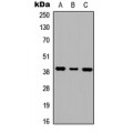 LifeSab™ GALR1 Rabbit pAb (50 µl)