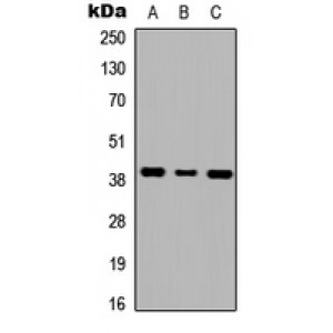 LifeSab™ GALR1 Rabbit pAb (50 µl)