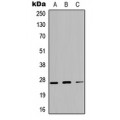 LifeSab™ Kallikrein 4 Rabbit pAb (50 µl)