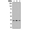 LifeSab™ Kallikrein 7 Rabbit pAb (50 µl)