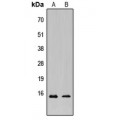 LifeSab™ KCNE1L Rabbit pAb (50 µl)
