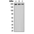LifeSab™ MRCK alpha Rabbit pAb (50 µl)