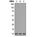 LifeSab™ NDUFB7 Rabbit pAb (50 µl)