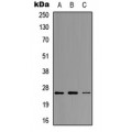 LifeSab™ Neurogenin 1 Rabbit pAb (50 µl)