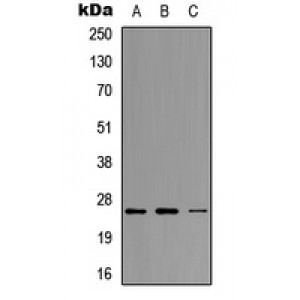 LifeSab™ Neurogenin 1 Rabbit pAb (50 µl)
