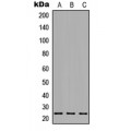 LifeSab™ Orosomucoid 1 Rabbit pAb (50 µl)