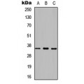 LifeSab™ Prostasin HC Rabbit pAb (50 µl)