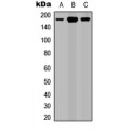 LifeSab™ ROBO1 Rabbit pAb (50 µl)