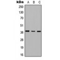 LifeSab™ RTDR1 Rabbit pAb (50 µl)