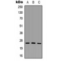 LifeSab™ SCNM1 Rabbit pAb (50 µl)