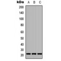 LifeSab™ TGIF2LY Rabbit pAb (50 µl)