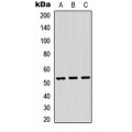 LifeSab™ TRMT11 Rabbit pAb (50 µl)