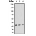 LifeSab™ YKL-40 Rabbit pAb (50 µl)