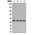 LifeSab™ ALDH1A1 Rabbit pAb (50 µl)
