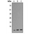 LifeSab™ Apolipoprotein C3 Rabbit pAb (50 µl)