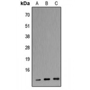 LifeSab™ Apolipoprotein C3 Rabbit pAb (50 µl)