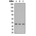 LifeSab™ Arylsulfatase B Rabbit pAb (50 µl)