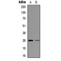 LifeSab™ BCL2 Rabbit pAb (50 µl)