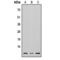 LifeSab™ Osteocalcin Rabbit pAb (50 µl)