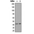 LifeSab™ CCR4 Rabbit pAb (50 µl)