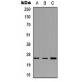 LifeSab™ CD79b Rabbit pAb (50 µl)