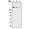 LifeSab™ CELSR3 Rabbit pAb (50 µl)