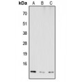 LifeSab™ COX6B2 Rabbit pAb (50 µl)