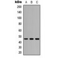 LifeSab™ CD116 Rabbit pAb (50 µl)