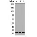 LifeSab™ G-CSF Rabbit pAb (50 µl)