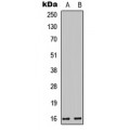 LifeSab™ Cystatin E/M Rabbit pAb (50 µl)