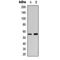 LifeSab™ Cytochrome P450 2S1 Rabbit pAb (50 µl)