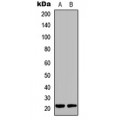 LifeSab™ DUSP22 Rabbit pAb (50 µl)