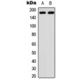 LifeSab™ HER2 (pY1221/Y1222) Rabbit pAb (50 µl)