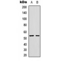 LifeSab™ GLP-1 Receptor Rabbit pAb (50 µl)