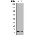 LifeSab™ Granzyme H Rabbit pAb (50 µl)
