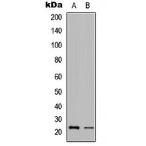 LifeSab™ Granzyme H Rabbit pAb (50 µl)