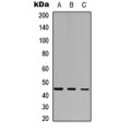 LifeSab™ IDO2 Rabbit pAb (50 µl)