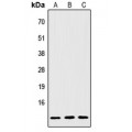 LifeSab™ IGFL2 Rabbit pAb (50 µl)