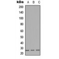 LifeSab™ CD179b Rabbit pAb (50 µl)