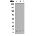 LifeSab™ CD179b Rabbit pAb (50 µl)