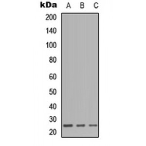 LifeSab™ CD179b Rabbit pAb (50 µl)