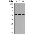 LifeSab™ IRX3 Rabbit pAb (50 µl)