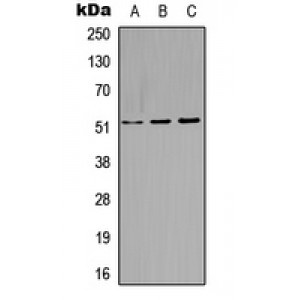 LifeSab™ Cytokeratin 14 Rabbit pAb (50 µl)