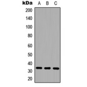 LifeSab™ CD20 Rabbit pAb (50 µl)